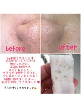 プラスボーテ 幡ヶ谷(plus beaute)/その場で見れる！