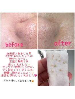 プラスボーテ 幡ヶ谷(plus beaute)/その場で見れる!