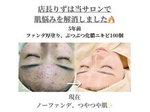 マノマノ エミュー(manomano emu)の雰囲気（どん底人生からキラキラ人生に☆つや玉小顔フェイシャルが◎）