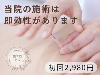 整骨院 えん/施術歴22年の資格者が施術♪