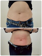 縁(en)/体重は増えても脂肪は減ってる！