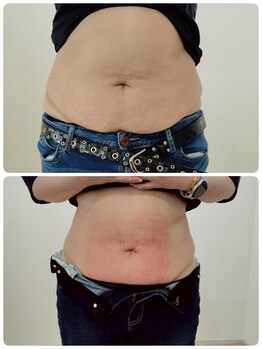 縁(en)/体重は増えても脂肪は減ってる!