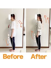 整体院ひなた 宮崎院/腰痛肩こり反り腰猫背の姿勢改善