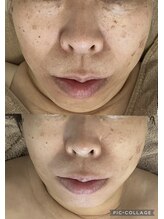 ブルーバケーション(Blue Vacation)/