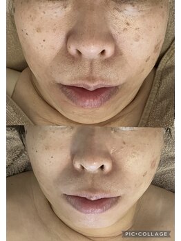 ブルーバケーション(Blue Vacation)/