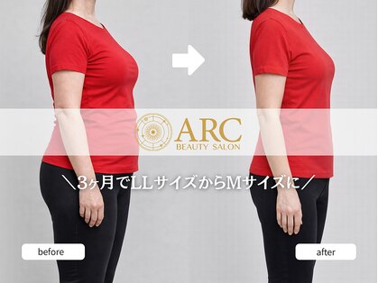 アーク(ARC)の写真