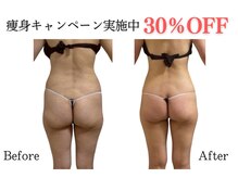 ムーン 高崎店(MOON)/本気の50代の後ろ姿