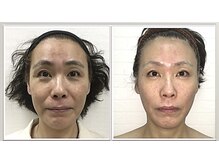 小顔整体研究所 KSラボ 藤が丘店/