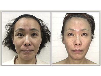 小顔整体研究所 KSラボ 藤が丘店/