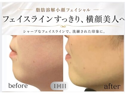 モミン(MOMI.N)の写真