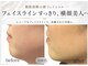 モミン(MOMI.N)の写真