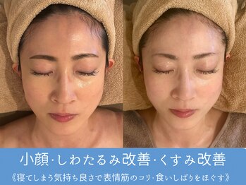 シュリー(Sriii)の写真/インディバ＆マッサージで猫背・首コリ解消、徹底フェイスリフト♪眼精疲労/額・眉間シワ・ほうれい線に◎