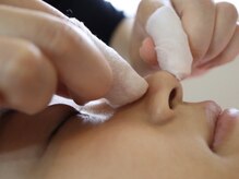 ラディアントモア(radiant more)/毛穴エクストラクション