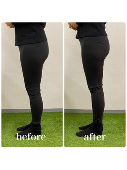 フィジオリハ 久屋大通店/美容筋膜リリース～ヒップ～