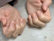 サロンド イト(salon de ito)/ワンカラー×ぷっくりフラワー