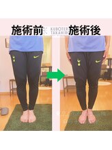 くぼてらたかひろ ボディメンテナンス(BODY MAINTENANCE)/施術前後比較（O脚）