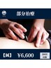 【鍼灸】部分施術：ミニマムコース　≪2回目以降の方≫