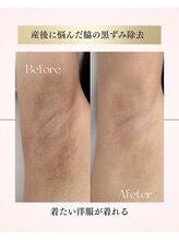 チュベルフェ(tu belle fe)/