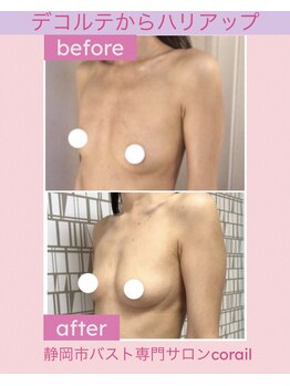 コライユ(corail)/ビフォーアフター