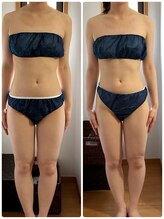 ヨサ パーク コアハート(YOSA PARK CORE HEART)/浮腫み改善