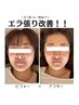 【回数コースご購入者様限定】オーダーメイド施術