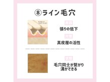 ポアレスラボ 新宿マルイ本館店/ライン毛穴