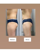 FJ/ぽっこりお腹も