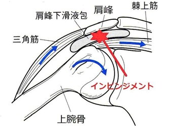 さんらいず整骨院/インピンジメント