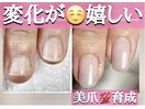噛み爪むしり癖から美爪さんへ