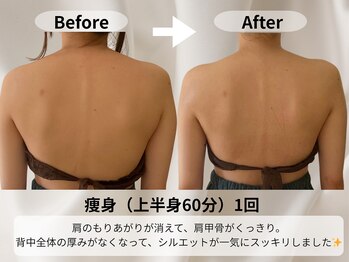 モア 星ヶ丘店(MORE)/痩身ビフォーアフター