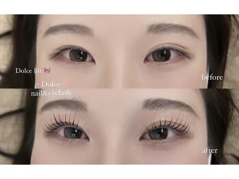 ドルチェ 大財店(Dolce)/パリジェンヌラッシュリフト