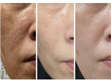 サロン ルポ(salon Repo)/