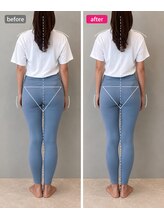 ホリック アイス コア ボディ(HOLIC ICE CORE BODY)/お客様ビフォーアフター6