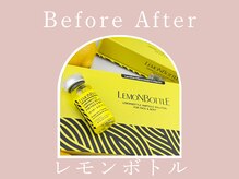 オウジエステサロン(OJIエステサロン)/ビフォーアフター