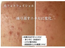 フジモトサロン 那覇おもろまち店(fujimotoサロン)の雰囲気（那覇脱毛/脱毛/シミ/毛穴/アマラローマ/ハーブピーリング/脱毛）