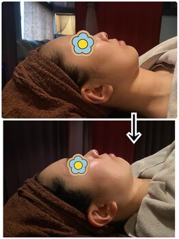 ラネージュミル(La neige mille)/小顔フェイシャル