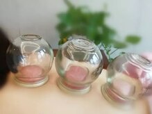 まごころ整体院/吸い玉　30分コース