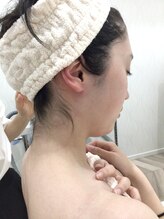 ベルネージュ(Belle Neige)/うなじ脱毛