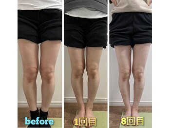 ハレソラ(HareSora)/ビフォーアフター