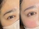 ドース(DOSE)の写真/ママさんも主婦の方も大歓迎です！完全個室のプライベート空間で周りを気にせず施術が受けられる♪