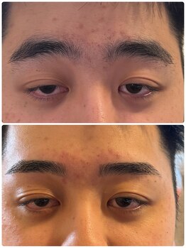 スリーピース(3Peace)/Before/After