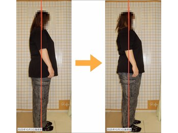 リファイン(Refine)/首こり頭痛でツラかった姿勢が