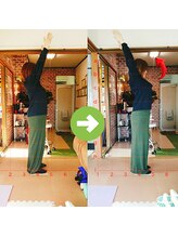 サプライズ整体院/30代ママさんの肩こり初回結果