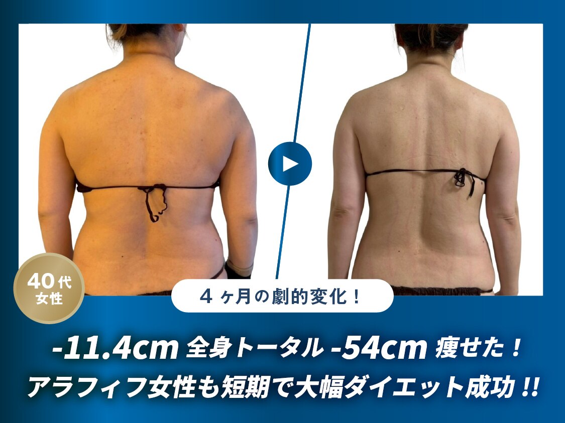 某痩身エステのボディケアマシーン 体験レポート】美容マシンが24時間使い放題・個室で手軽にセルフエステ