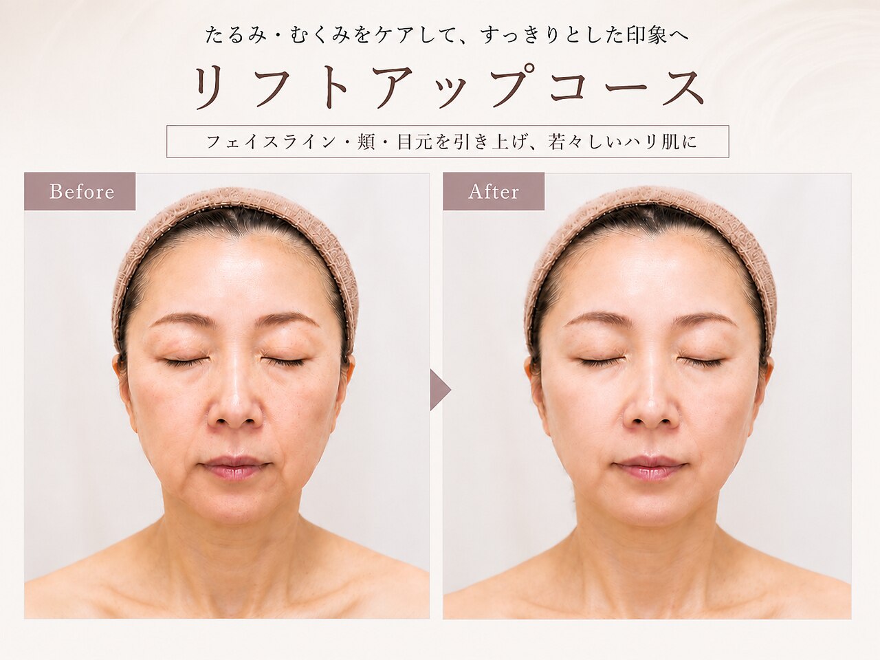 新長田駅で毛穴ケアが人気のエステサロン｜ホットペッパービューティー