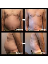 伊達男/フォースカッター事例