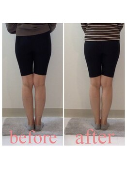 スタイルラボ高松/産後骨盤矯正の効果♪