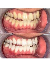 ライトビューティー 池袋店(LightBeauty)/症例写真