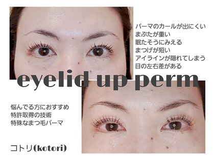 コトリ(kotori)の写真