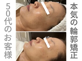 ピュウリリアーナ(PIU LILIANA)/